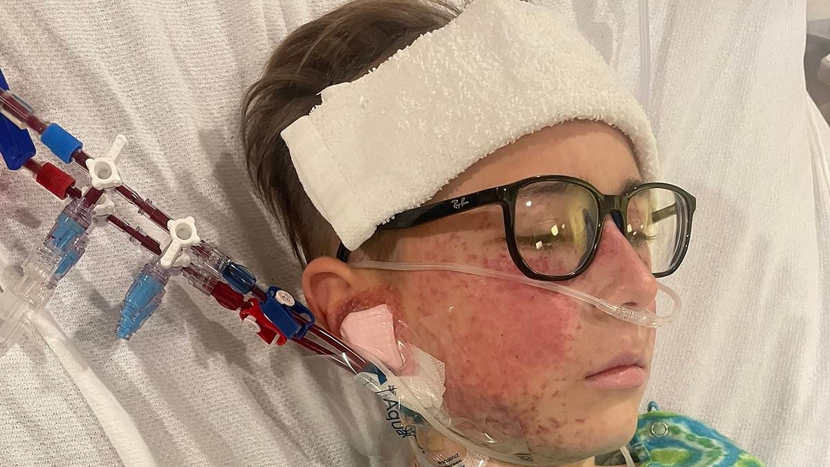 Fears of cover-up as boy, 9, left fighting for life with organ failure after eating tainted 'health' food