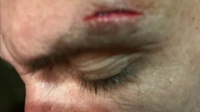 British father-of-two claims he was 'beaten up twice inside hotel' during 'nightmare' Turkish holiday