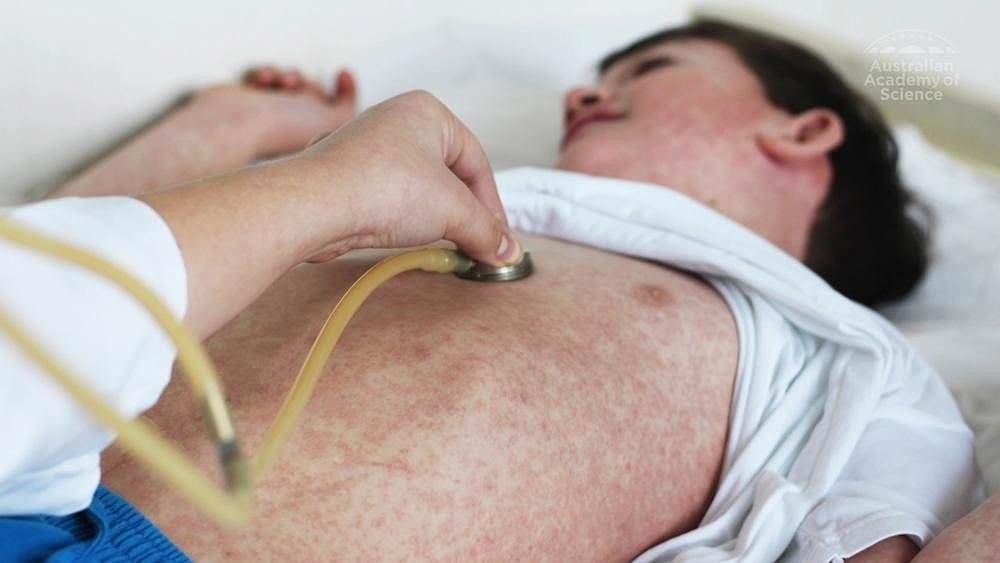 Startling charts reveal how world's most infectious disease is poised to engulf America