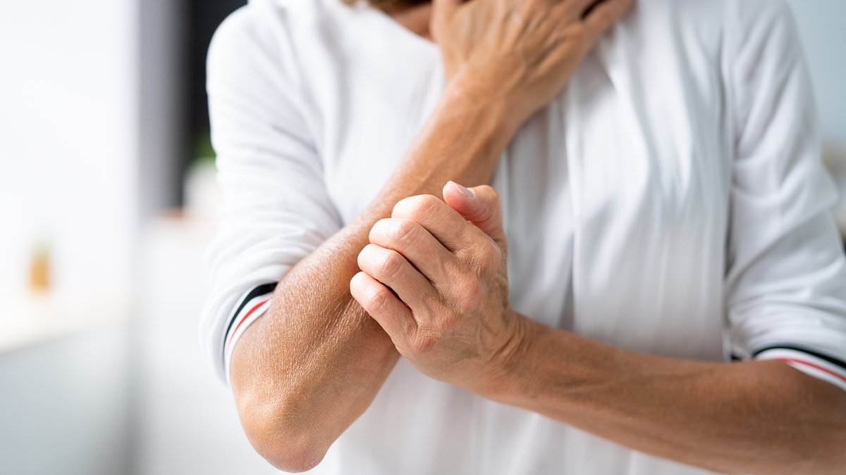 Strange link discovered between painful skin disease and stubborn belly fat