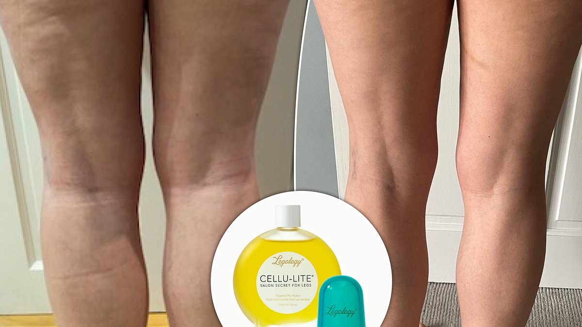 The lymphatic drainage kit users say is the SECRET behind smoother, firmer-looking summer legs: 'Dimples have markedly reduced'