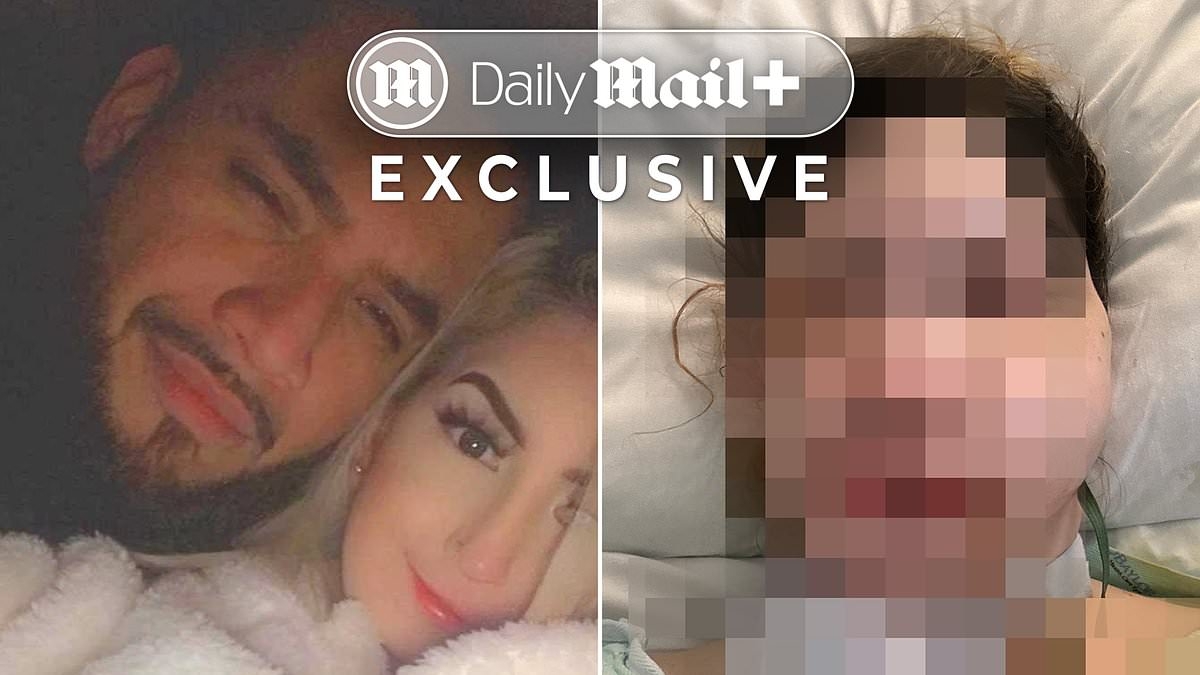 EXCLUSIVE I was brutally beaten with brass knuckles by my ex... and it wrecked a lifetime of facial surgeries