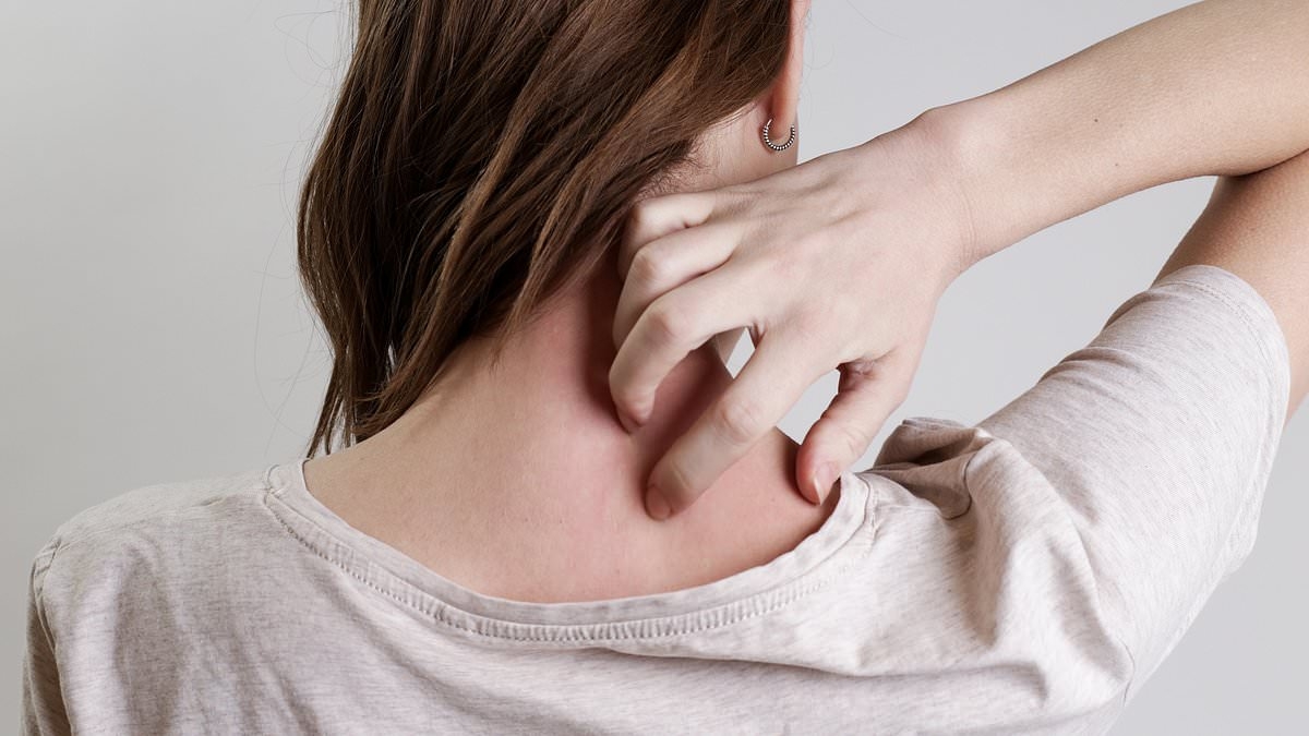 Subtle signs on your skin and neck that mean you could have deadly condition suffered by 100m