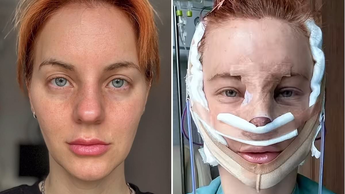 EXCLUSIVE Why we got facelifts in our 20s and 30s: see the before and after pictures and judge results for yourself