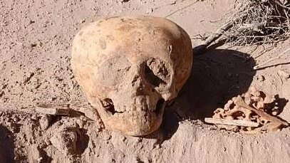 Scientists are BAFFLED by a mysterious deformed skull discovered in Argentina - as some claim it could be so-called 'ANTMEN'