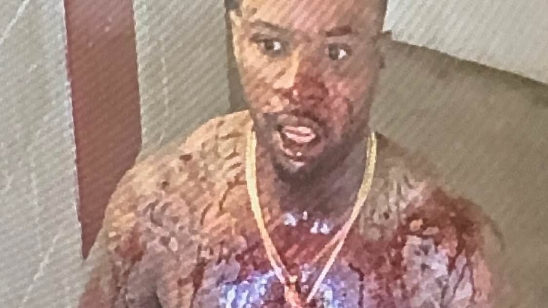 Shocking pictures show Tory Lanez covered in blood after being stabbed 14 times inside California prison where he is serving ten years for shooting Megan Thee Stallion