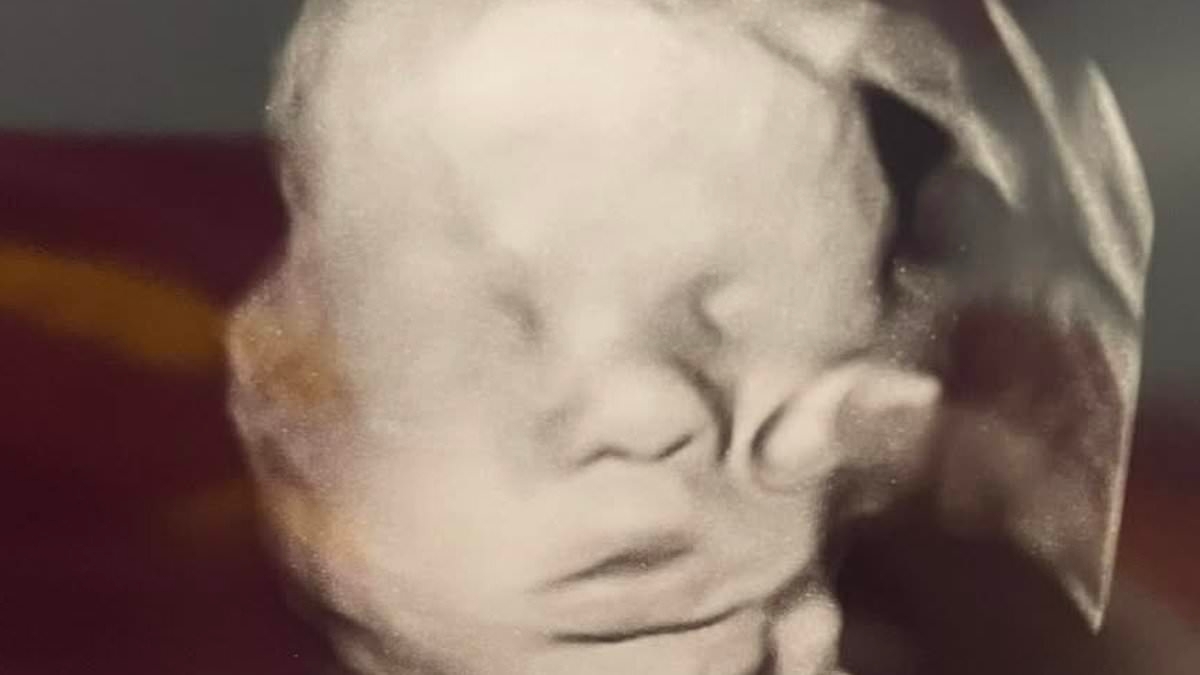 'Hand of God' mysteriously appears in ultrasound after mom prays for baby's health