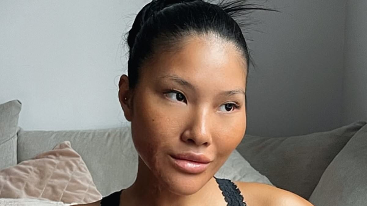 Love Island bosses sign up stunning model from Manchester who nearly died in horrific fire-breathing accident