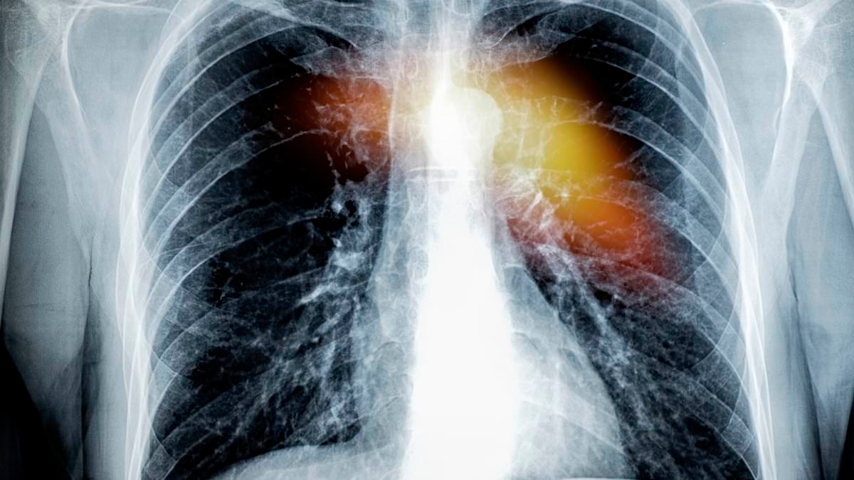 Huge heart attack risk linked to dirty habit that thousands of Australians are doing daily
