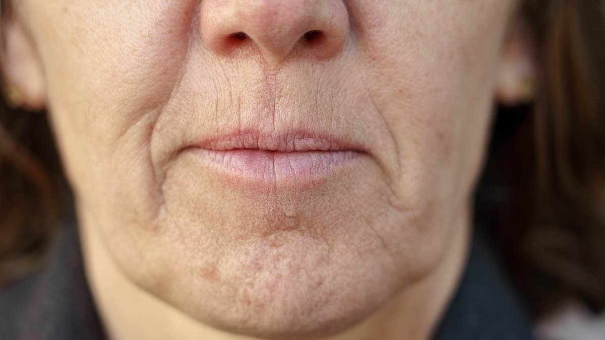 The everyday item that could be giving you WRINKLES - as experts compare the effect to 'smoker's lines'