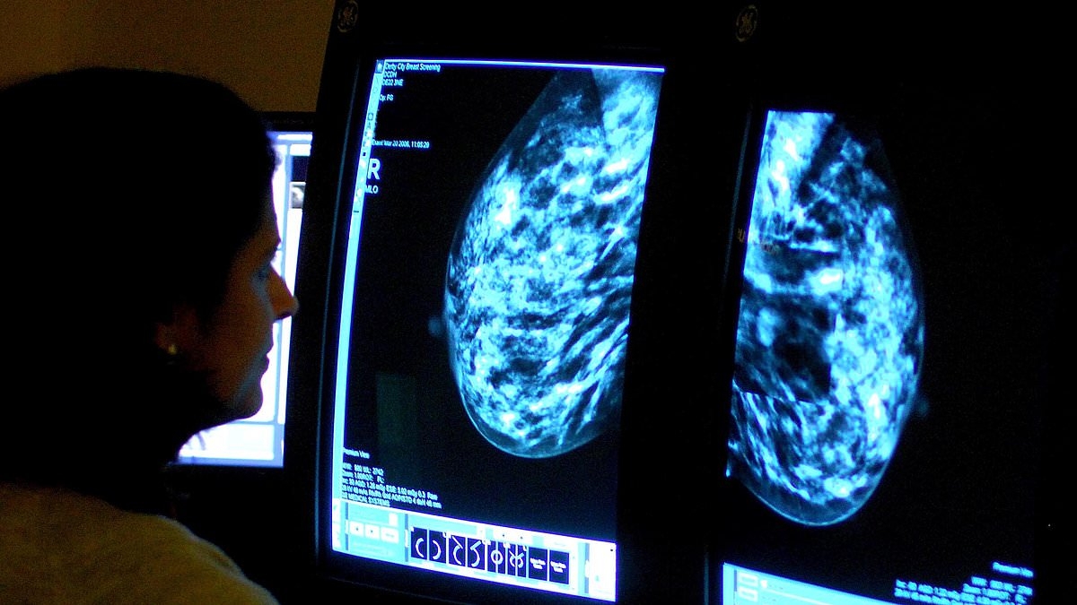 Major discovery about 'invisible' breast tumours that are too small to show up on scans