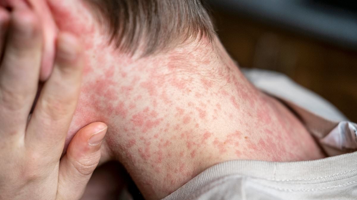 Frightening map reveals US counties where world's most infectious disease is set to surge