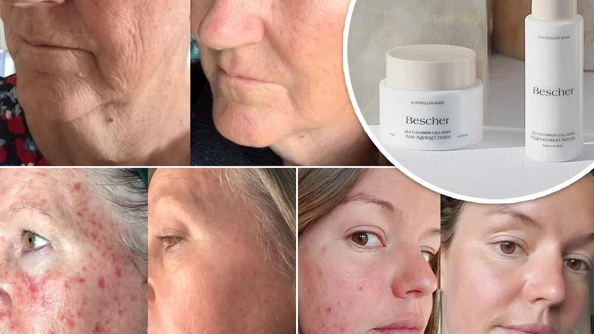 Stunning before and after photos reveal the power of sea cucumber collagen to ERASE wrinkles - and it's 25% off with a free gift right now
