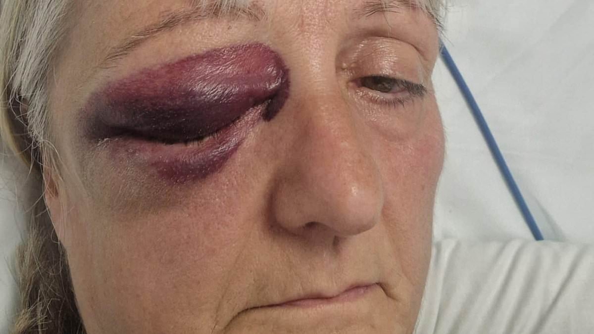 Grandmother suffers fractured skull, bruising and a bleed on the brain after being run down by cyclist in front of her six-year-old grandchild