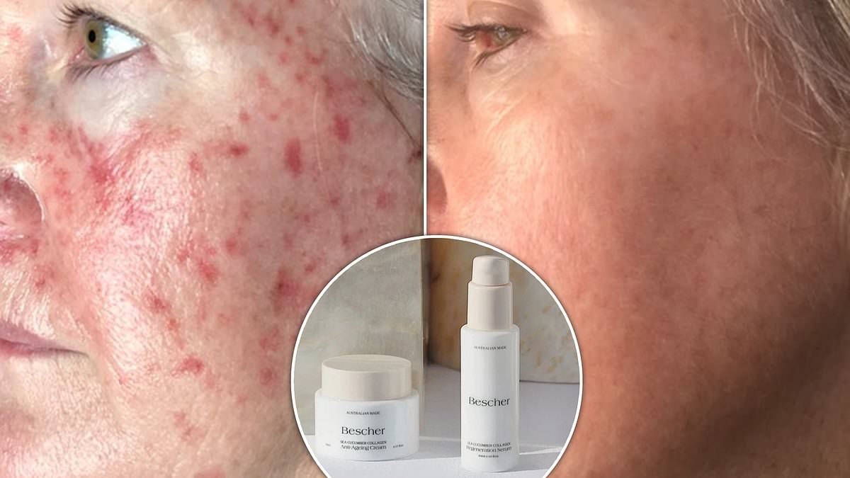 'Completely TRANSFORMED my skin!': The sea cucumber collagen skincare so popular it sold out in DAYS - and it's 25% off right now