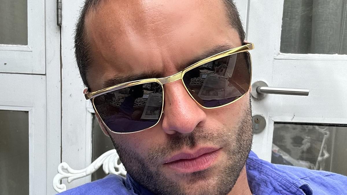 Normal People star shares agony after breaking his leg following a horrifying bike accident
