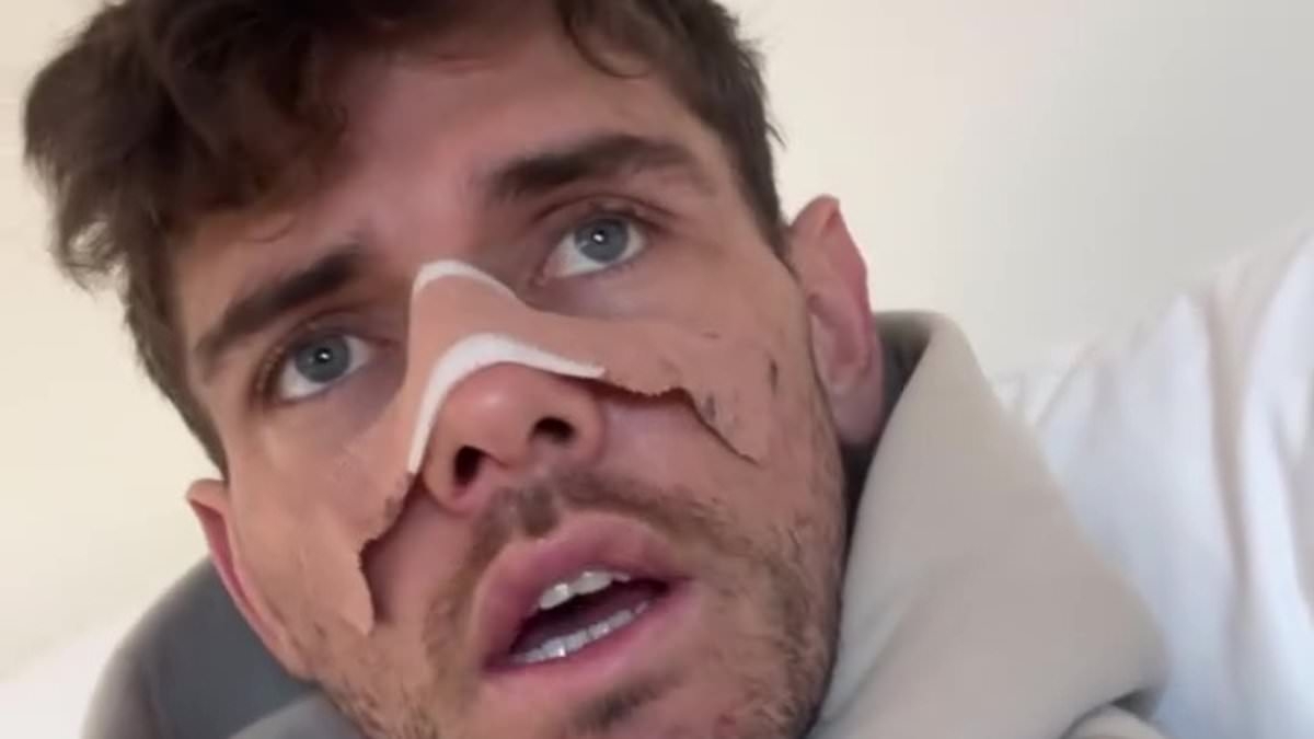 Reality star addresses rumours that his collapsed nose was a result of drugs and partying: 'Can't rule it out'