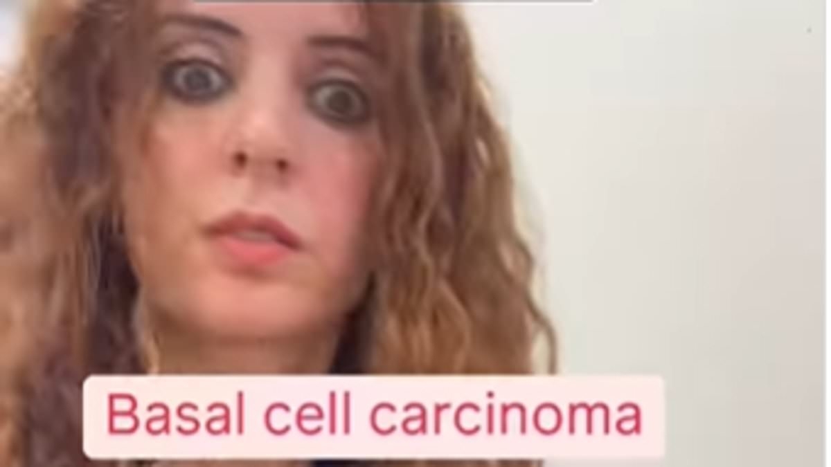 I'm a dermatologist - there's two little-known signs of skin cancer almost everyone misses