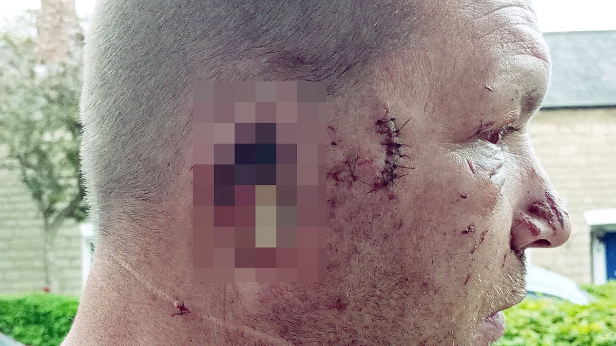 Dog-minder has ear ripped off by XL Bully after it attacked him while he slept