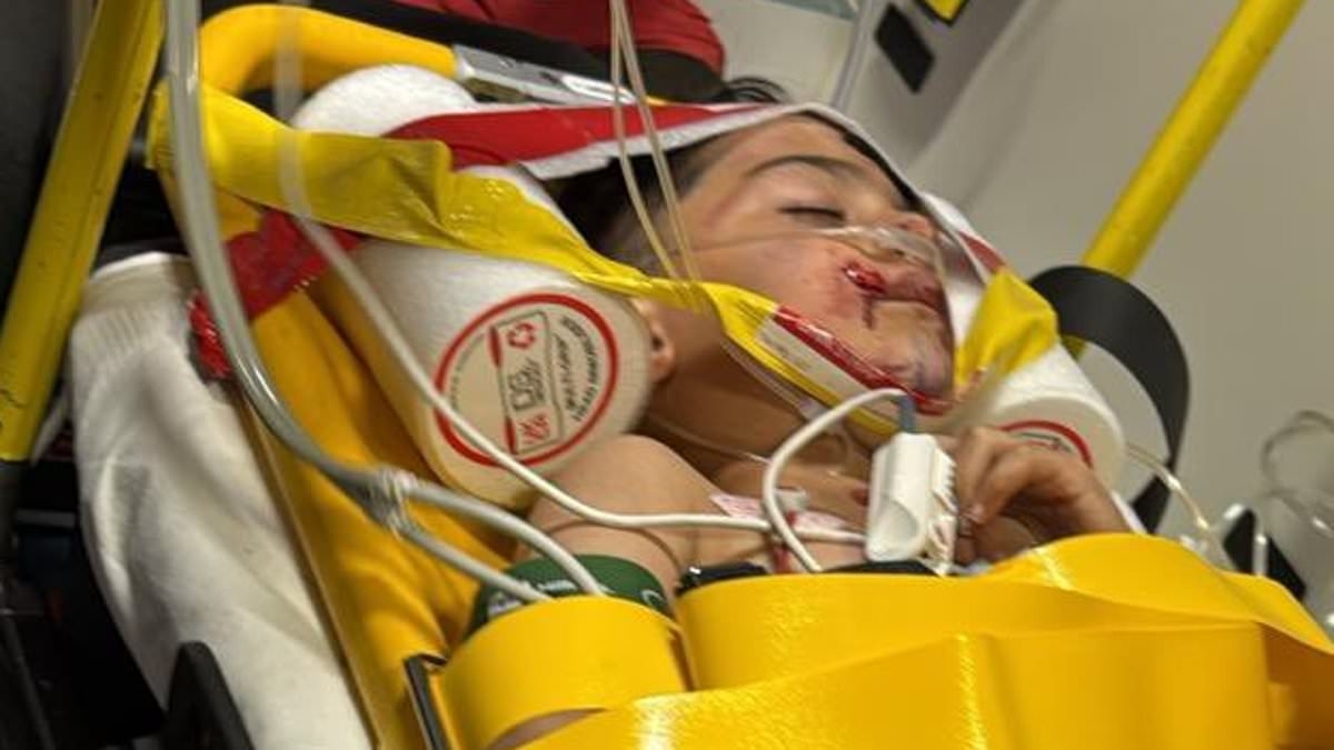 EXCLUSIVE Fury over six-year-old boy's 'traumatic' wait for ambulance after car crash leaves him with bone sticking out of his leg and covered in blood