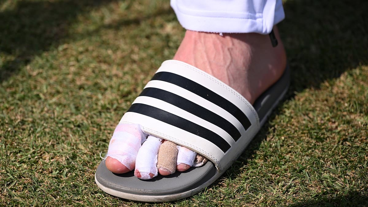 England cricketer opens up on why he almost had his toe AMPUTATED in bid to end injury hell... before doctors advised him against drastic move