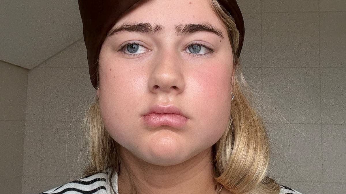 TikTok star Sopha Dopha reveals shock new look after surgery: 'Feels like I've been hit by a bus'