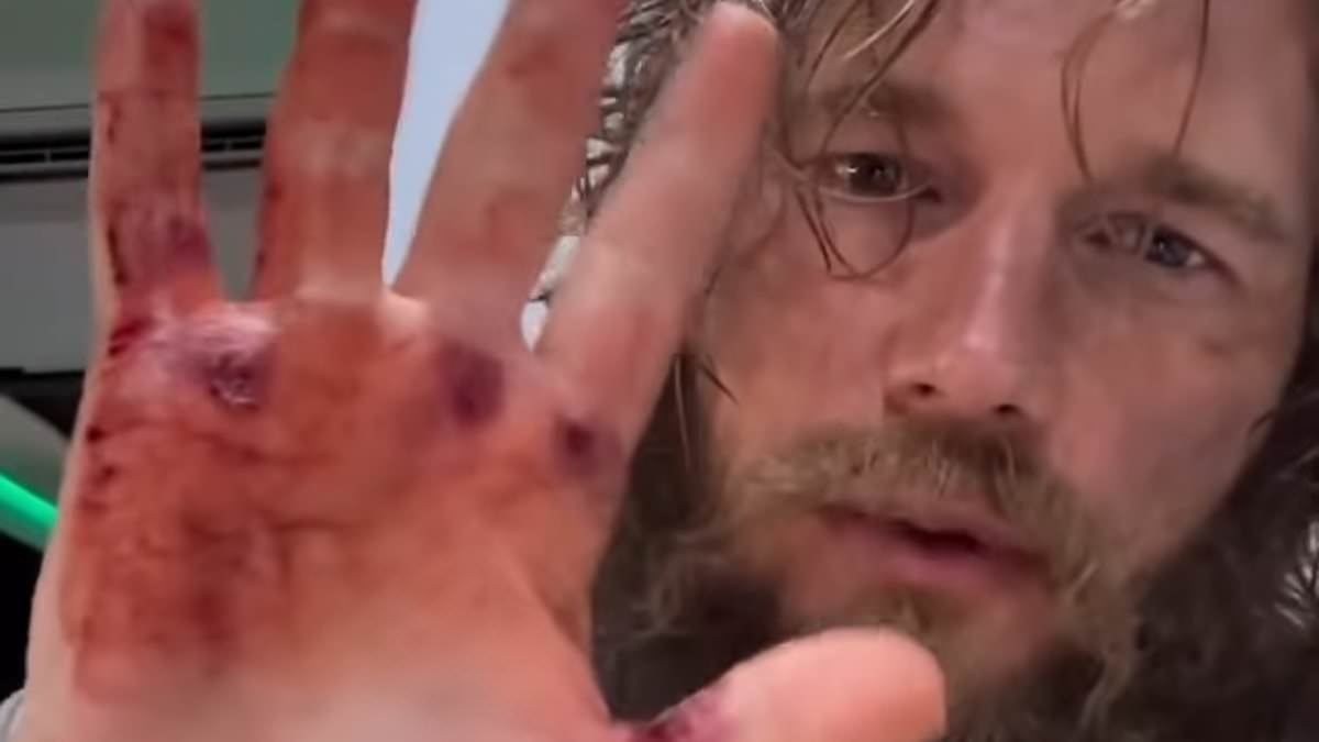A-list actor is unrecognizable with greasy hair and scraggly beard in shocking photos