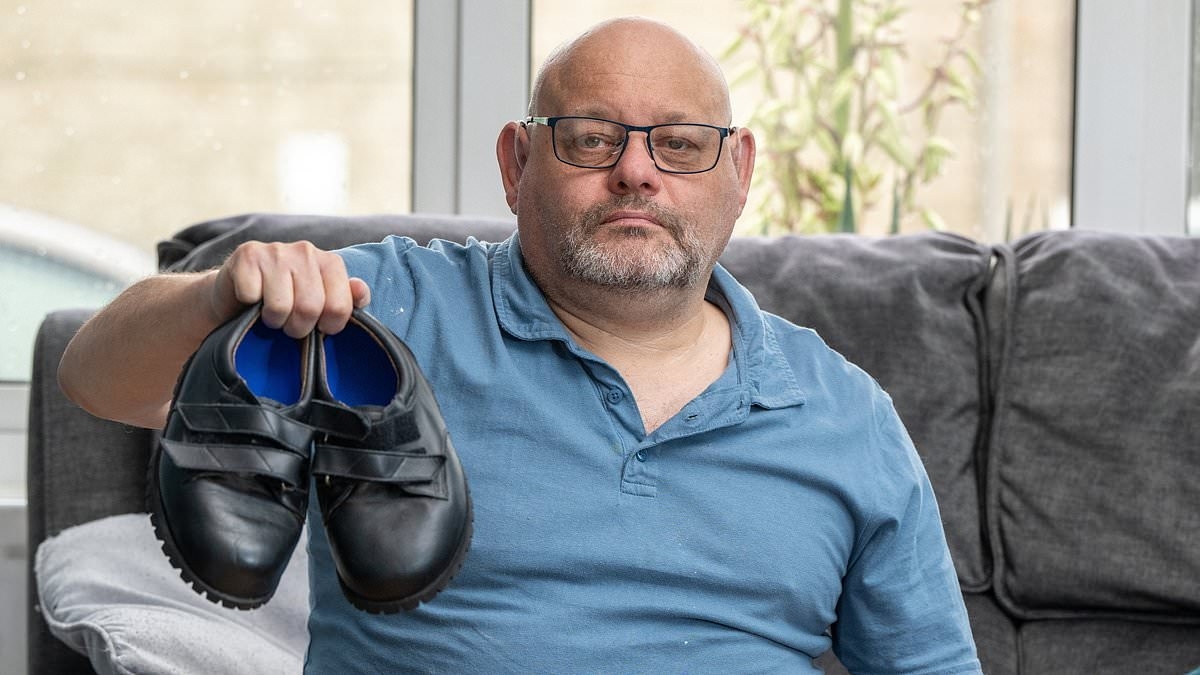 Groom forced to have his toes partially amputated after being given wedding shoes that were too tight