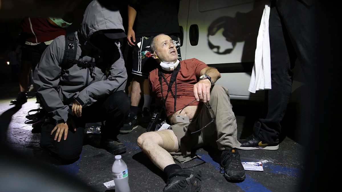 British photographer, 60, is shot by police at LA riots and forced to undergo emergency surgery