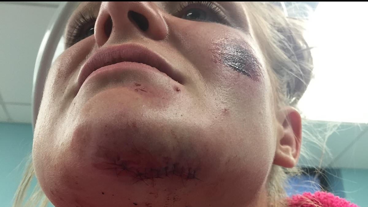 EXCLUSIVE Mother-of-three, 33, bravely details horrific abuse by her violent ex-partner as she shares pictures of her injuries