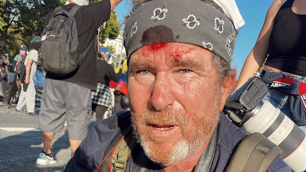 Shocking moment British photographer films himself getting shot in the head by LA riot cops