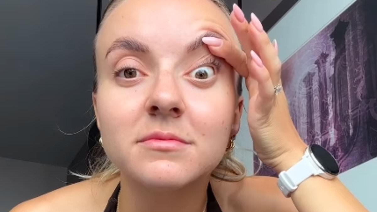 Molly-Mae Hague's sister Zoe gives her followers an update on her botched Botox in new clip after one eye was left drooping after injections