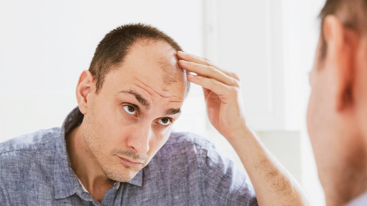Good news for bald men! Scientists have developed a simple way to reverse hair loss - and say a treatment could be available by 2029