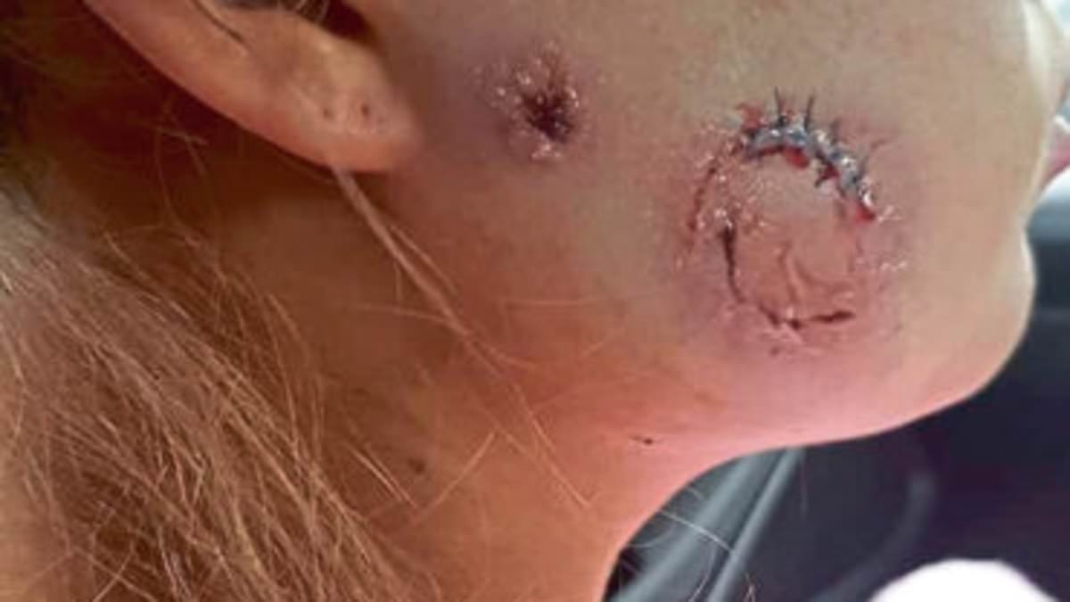 Carer bit chunk out of friend's face in 'brutal' dancefloor attack over ex-boyfriend before kicking police officer in the head