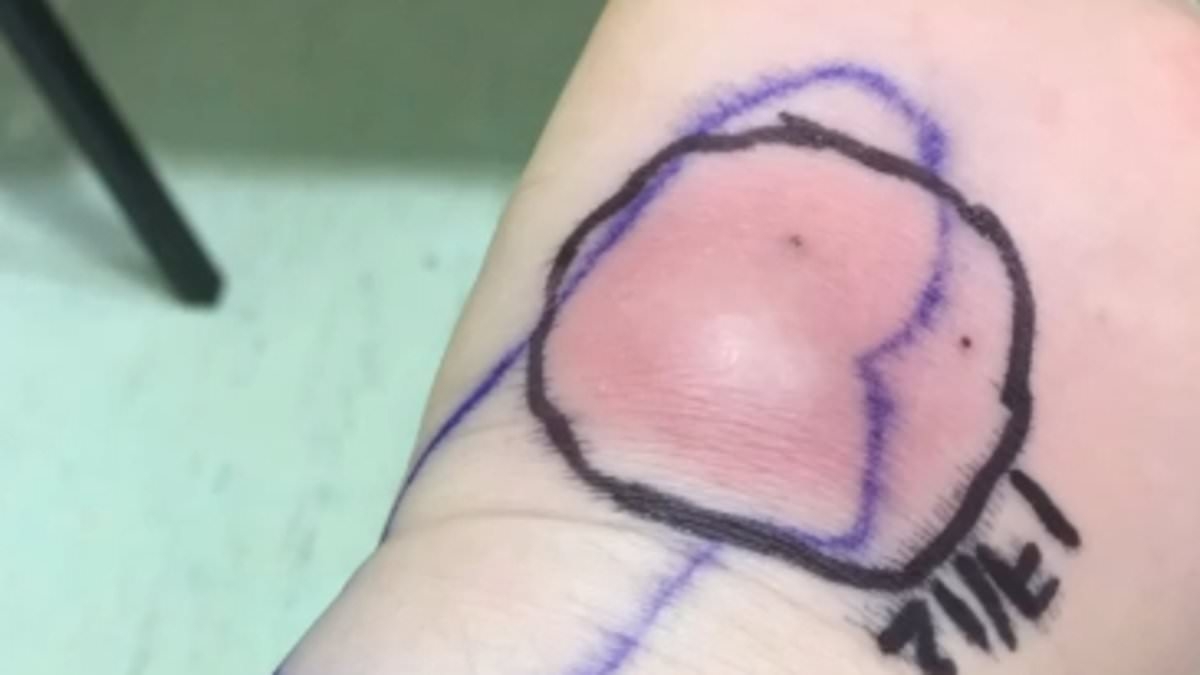 My doctor used a dirty needle during common procedure - it left me with agonising 'suicide disease'