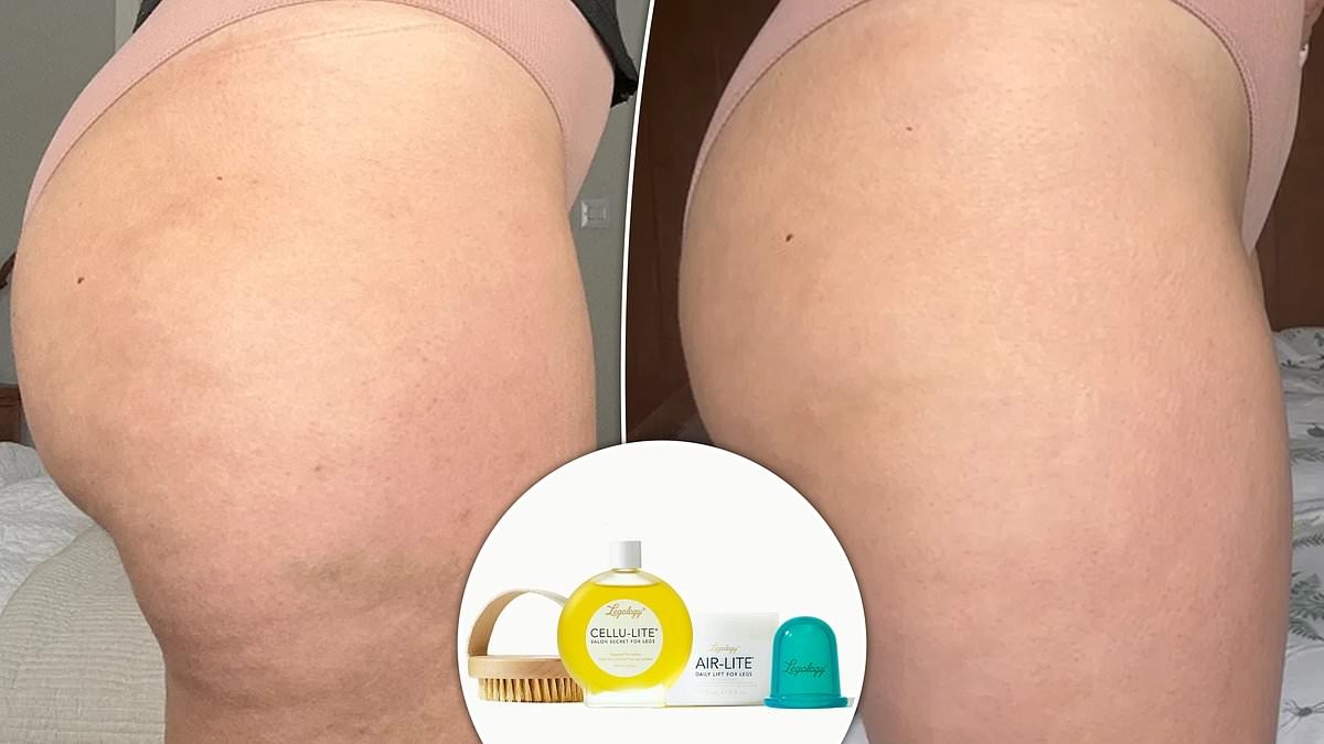 The little-known lymphatic drainage kit that users say is 'like a facelift for your legs' is on sale for £45 off: 'My legs have been completely transformed!'