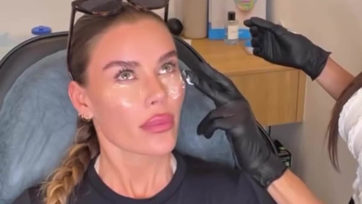 Skye Wheatley gets MORE cosmetic procedures following controversial 'fox eye lift' - after admitting plastic surgery addiction