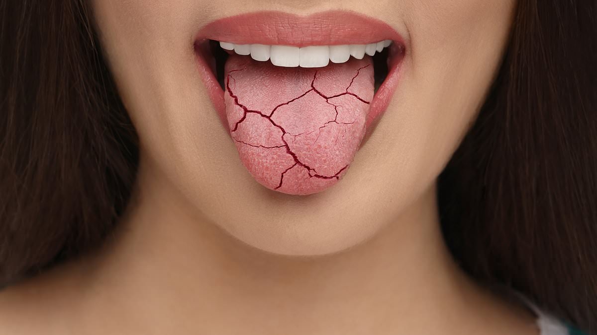 Gel used to smooth out facial wrinkles could be used to treat dry mouth after scientists grow saliva gland in a dish