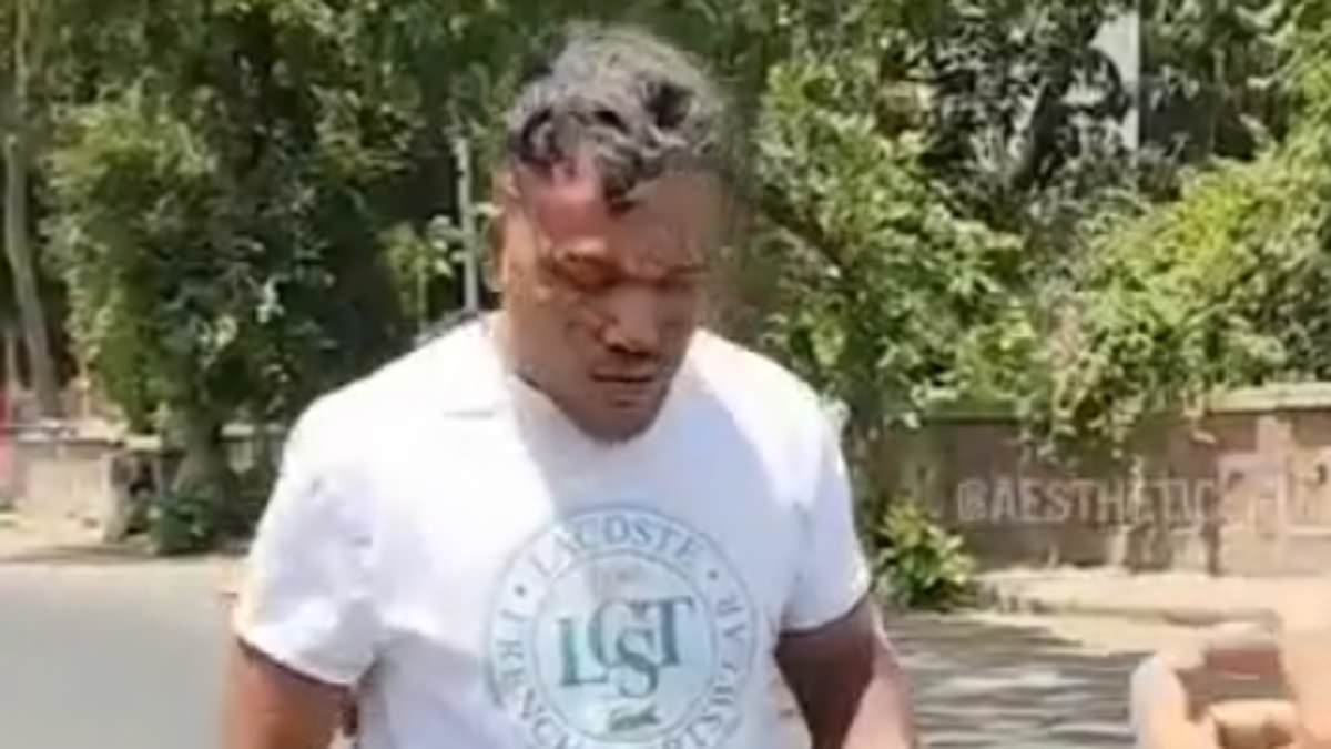 EXCLUSIVE Astonishing moment British survivor of Air India plane crash walks BACK towards flaming wreckage to rescue his brother, telling bystander: 'He's burning to death, I have to save him'