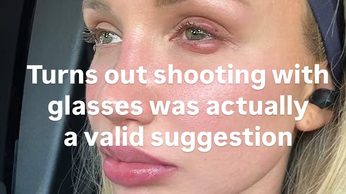 Australian model reveals gruesome injury from 'shooting' accident