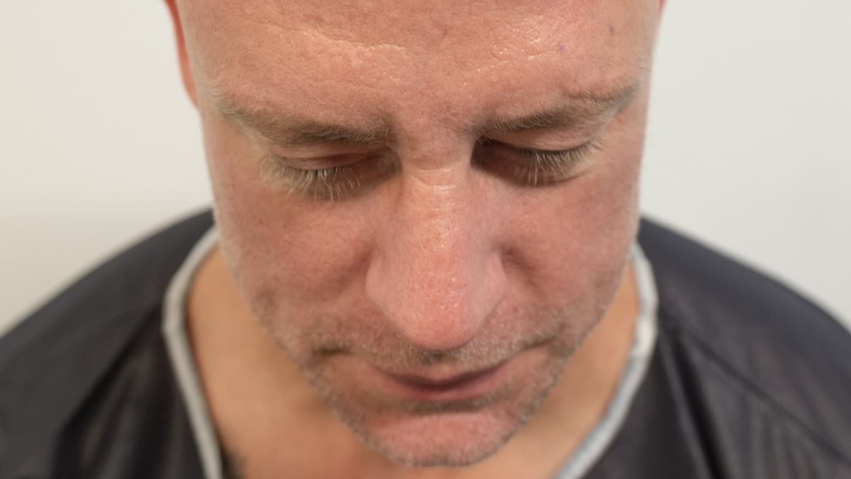 Wayne Bridge shows off the results of his £7,000 hair transplant after having procedure to 'boost his confidence' after years of 'covering' his baldness