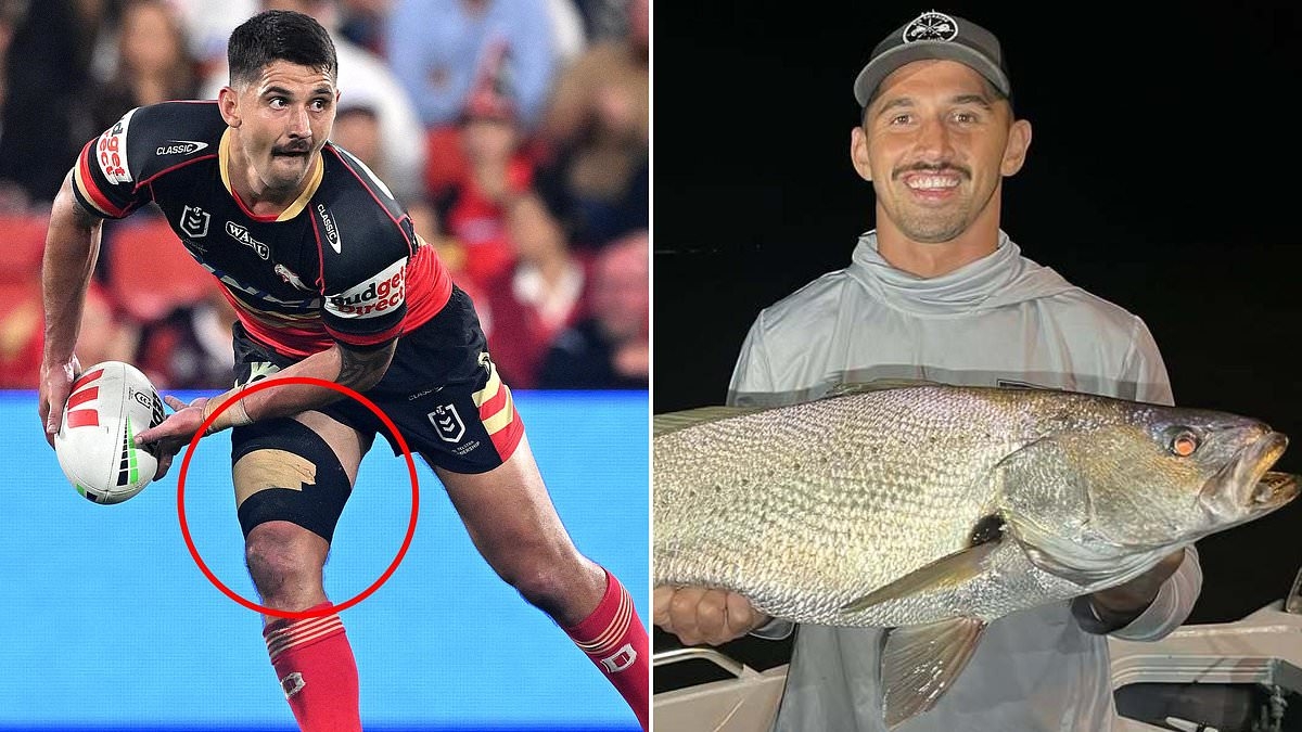 GRAPHIC CONTENT WARNING: Footy star reveals the bizarre way he ended up with 40 stitches in his leg
