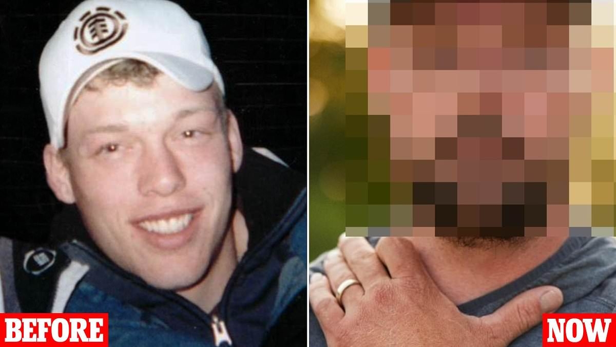 EXCLUSIVE A gunshot left me without half a face... but a groundbreaking transplant changed my life