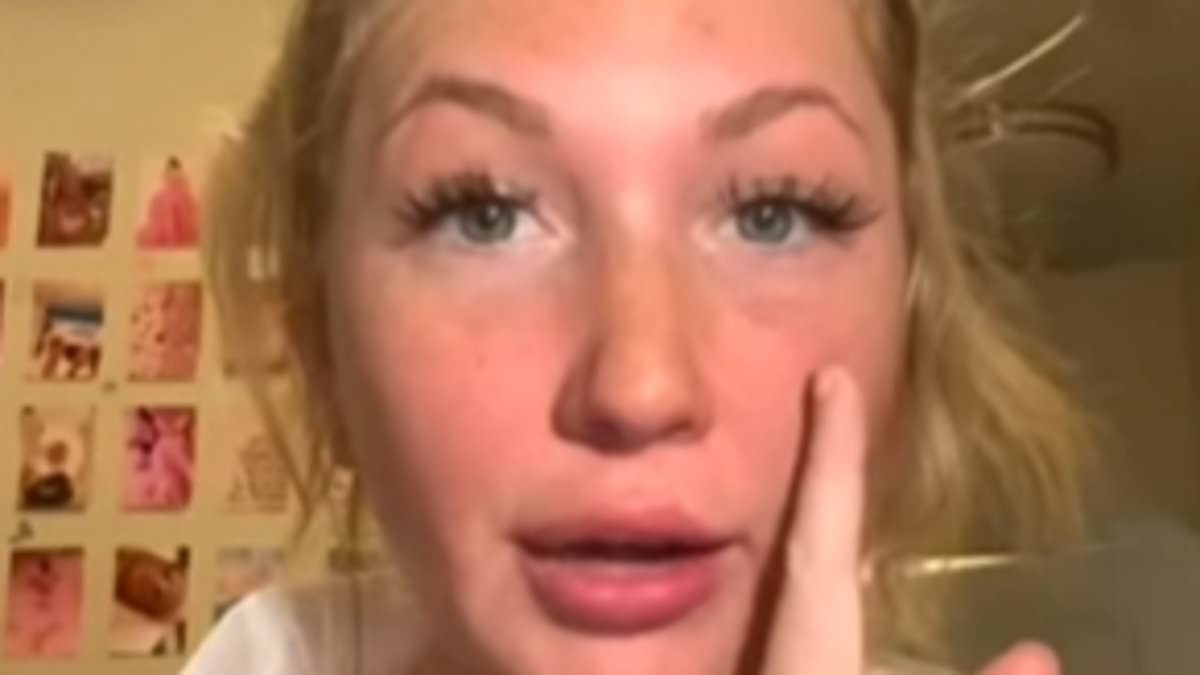 Liam Payne's girlfriend Kate Cassidy, 26, details the extensive list of cosmetic tweaks she's had and admits she was left with a 'frozen' face after sharing natural throwback video