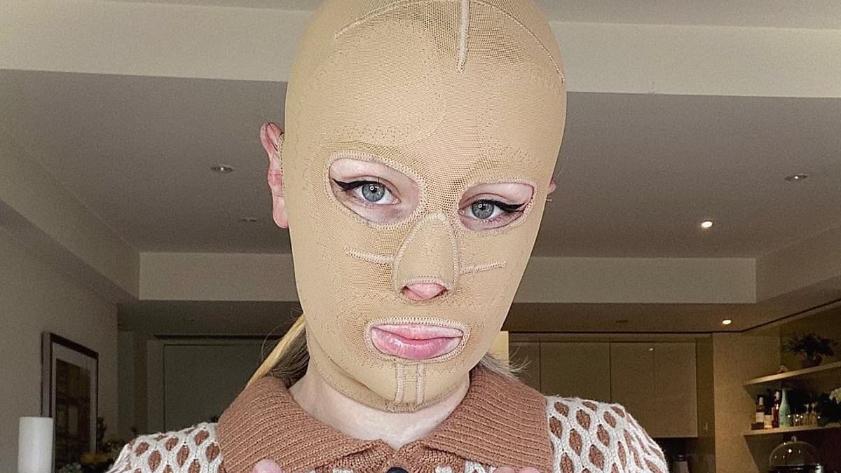 Woman who survived volcano eruption with severe burns and eight fingers amputated reveals what she looks like 5 years later