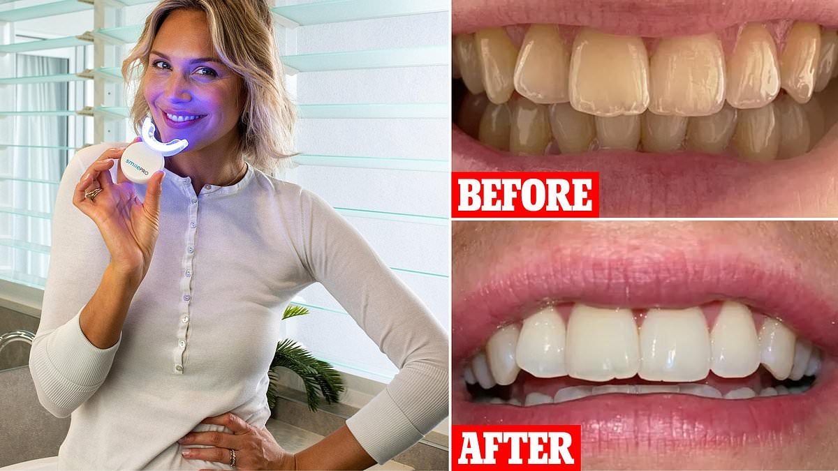 How to get sparkling white teeth in seven days: Dentist-approved item wows Aussies: 'It changed my life'