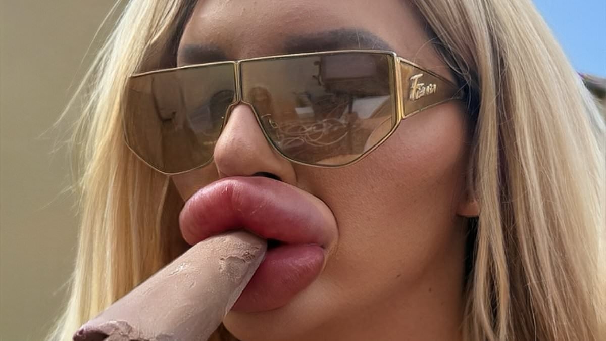 EXCLUSIVE I've had so much lip filler I have trouble breathing and can't close my mouth... but I have no plans to stop