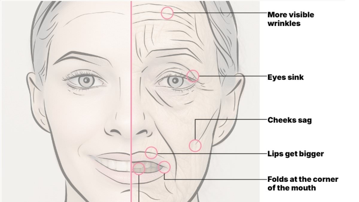 What Ozempic really does to your face: All the tell-tale signs of using skinny jabs, from bigger lips to sunken eyes