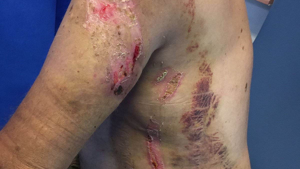 British angler cheats death after his fishing rod is struck by a lightning bolt