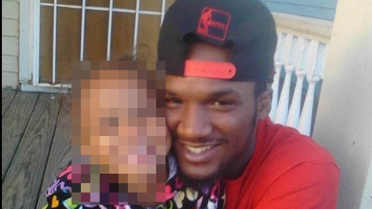 Hero dad left with no SKIN: Horror photo reveals scars of man who ran into burning building to save his step kids